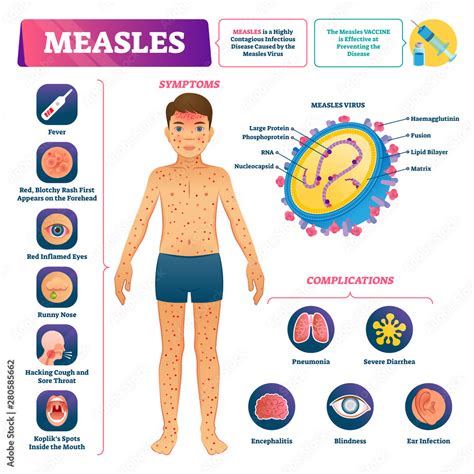 measles type of rash