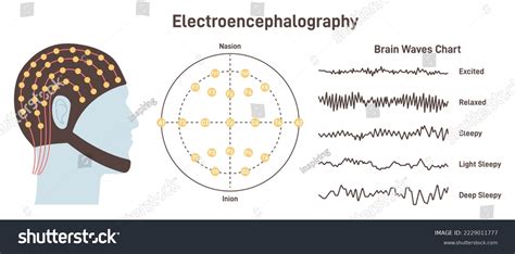 Measures Electrical Current In Brain