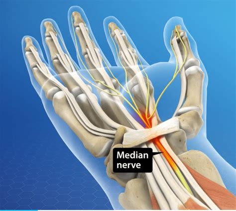 median nerve in hand