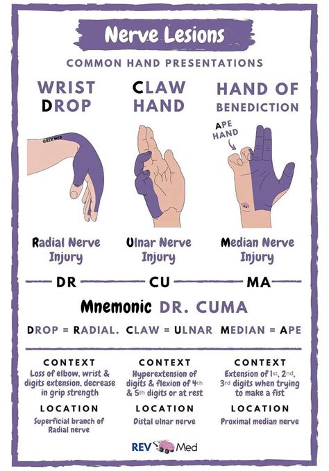 median nerve injury hand