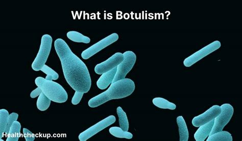 medical term for formation of botulism