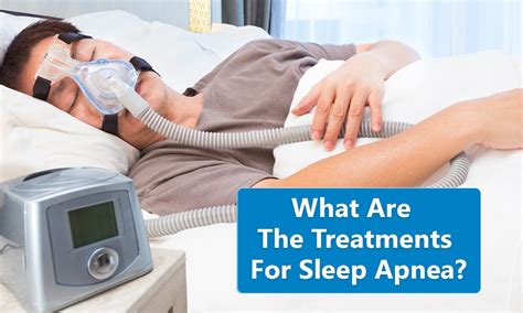 medical treatment for sleep apnea