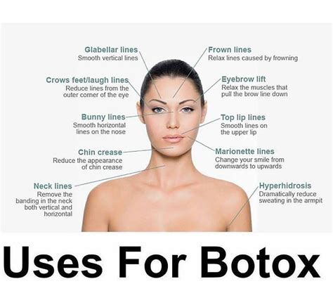 medical use for botox