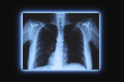 Medical X-Rays Are An Example Of
