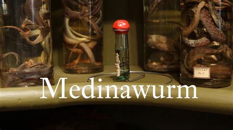 medinawurm