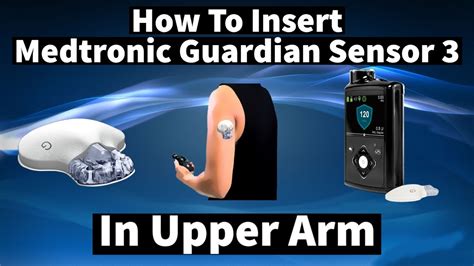 Medtronic Sensor Problems