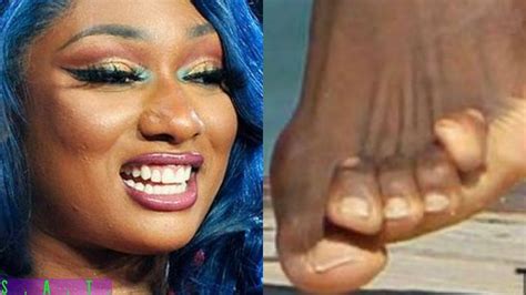 megan the stallion foot after being shot