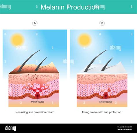 melaninproduktion