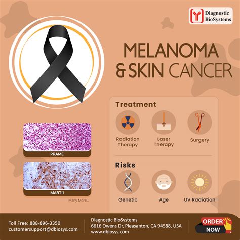 melanoma cancer description