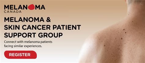 melanoma skin cancer support groups