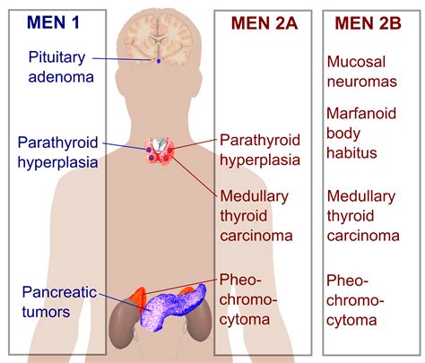 Understanding Men 2 Syndrome: Uncovering the Genetic Disorder's Causes, Symptoms, and Treatment Options