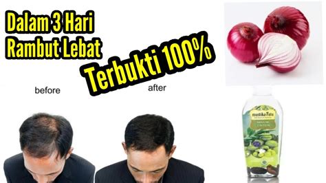 Rahasia Rambut Tebal dan Sehat: Panduan Lengkap Mengatasi Rambut Botak