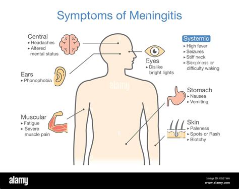 meningitis hands