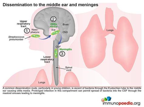 meningitis route of transmission