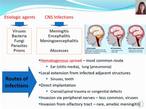 meningitis transmission route