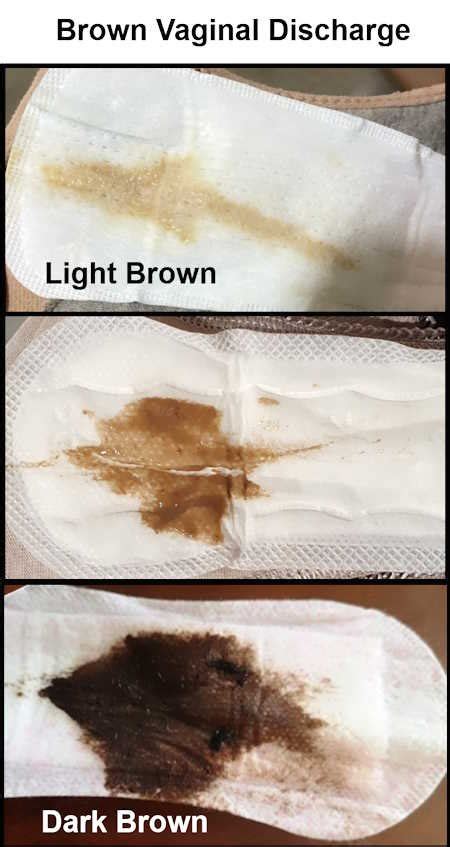 Menopause Bleeding Brown