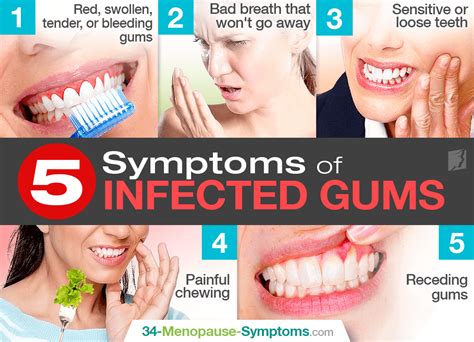 Menopause Swollen Gums