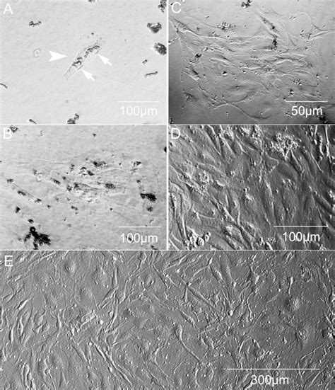 meshwork protection method