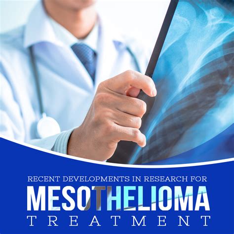 Mesothelioma Treatment Research
