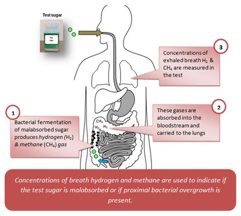 methane positive breath test