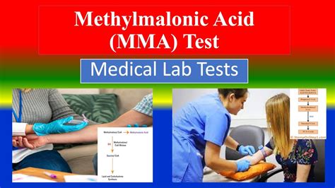 Methylmalonic Acid Serum Lab