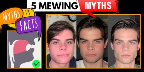 mewing is a myth