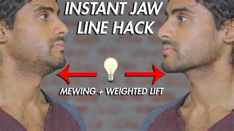 mewing jaw exercise