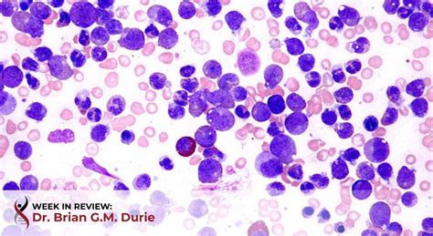 mgus disease blood test