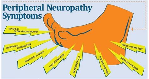 mgus neuropathy symptoms