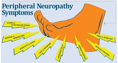 mgus symptoms neuropathy