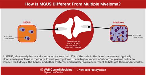 mgus treatment do more than wait and watch