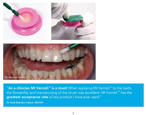 Mi Varnish Application