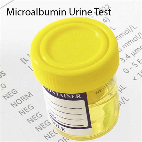 Microalbumin test A test to measure kidney damage