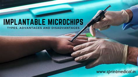 Microchip Implants Advantages