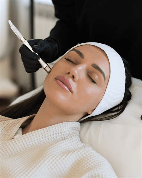 Microdermabrasion Ct