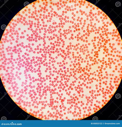 Microscope Blood: Uncovering Hidden Health Insights