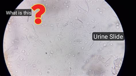 Microscope Urine Slide