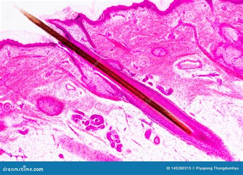 microscopic channels created in the scalp
