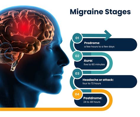 Migraine Lifestyle Changes