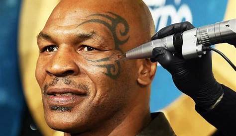 Find Out 43+ Facts On Mike Tyson Tattoo Removal Your Friends Missed to