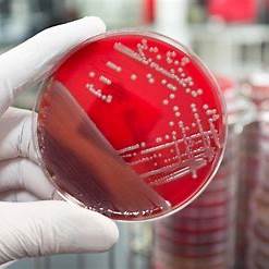 Mengapa Bakteri Disebut Prokariotik