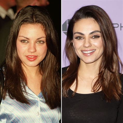 mila kunis before and after plastic surgery