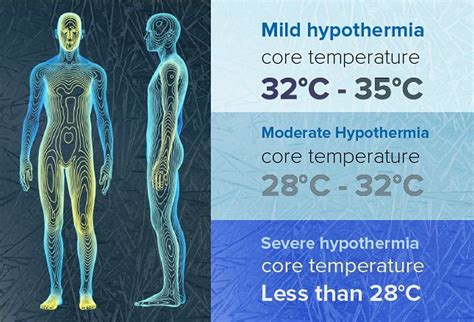mild hypothermia body temperature