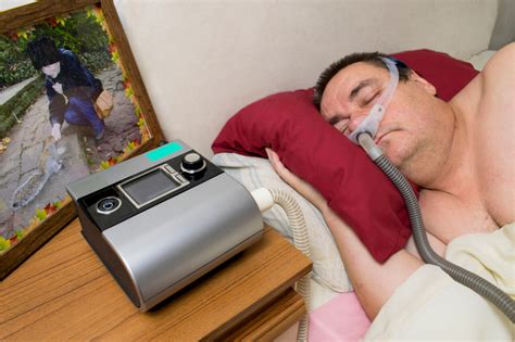 mild sleep apnea treatment options