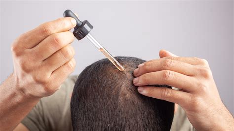 Minoxidil Ideal Application Technique