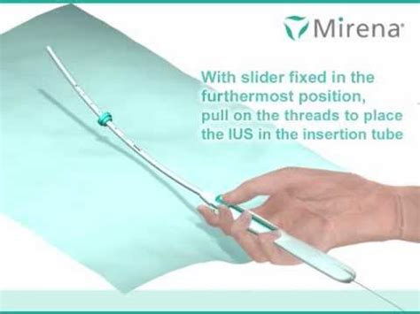 mirena insertion video for providers