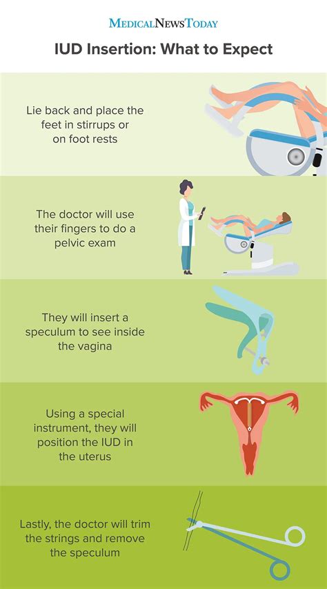 mirena iud implant instructions