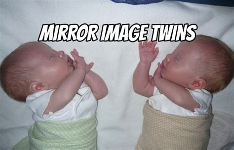 mirror image twins meaning