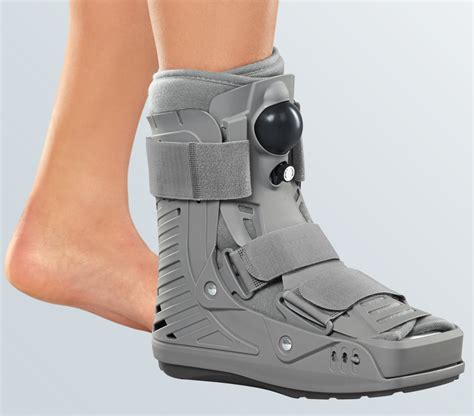 Gips obwohl kein Bruch vorliegt? (Füße, Schwellung)