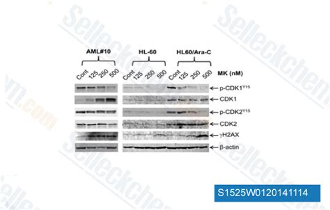 mk-1775 merck astrazeneca